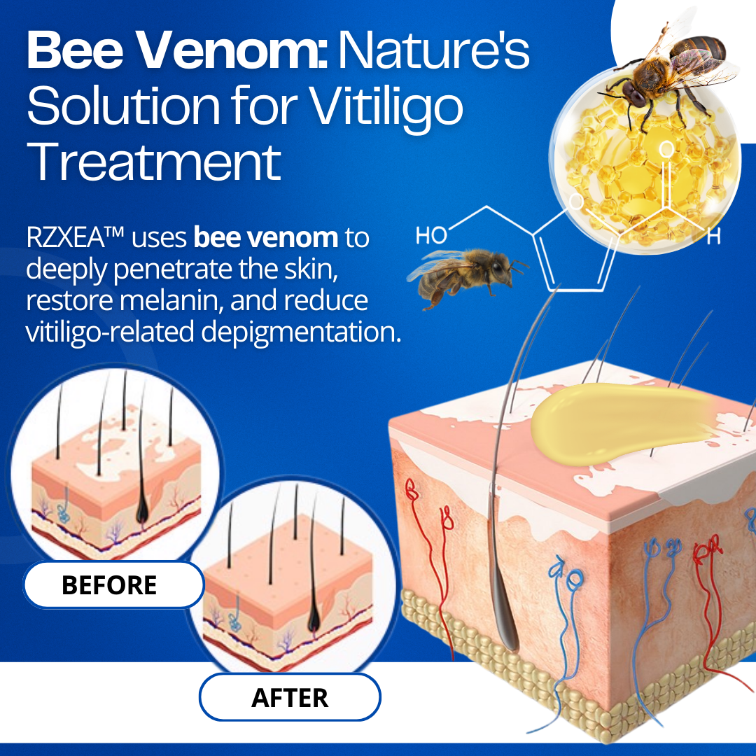 RZXEA™ VitiClear Bee Venom Cream