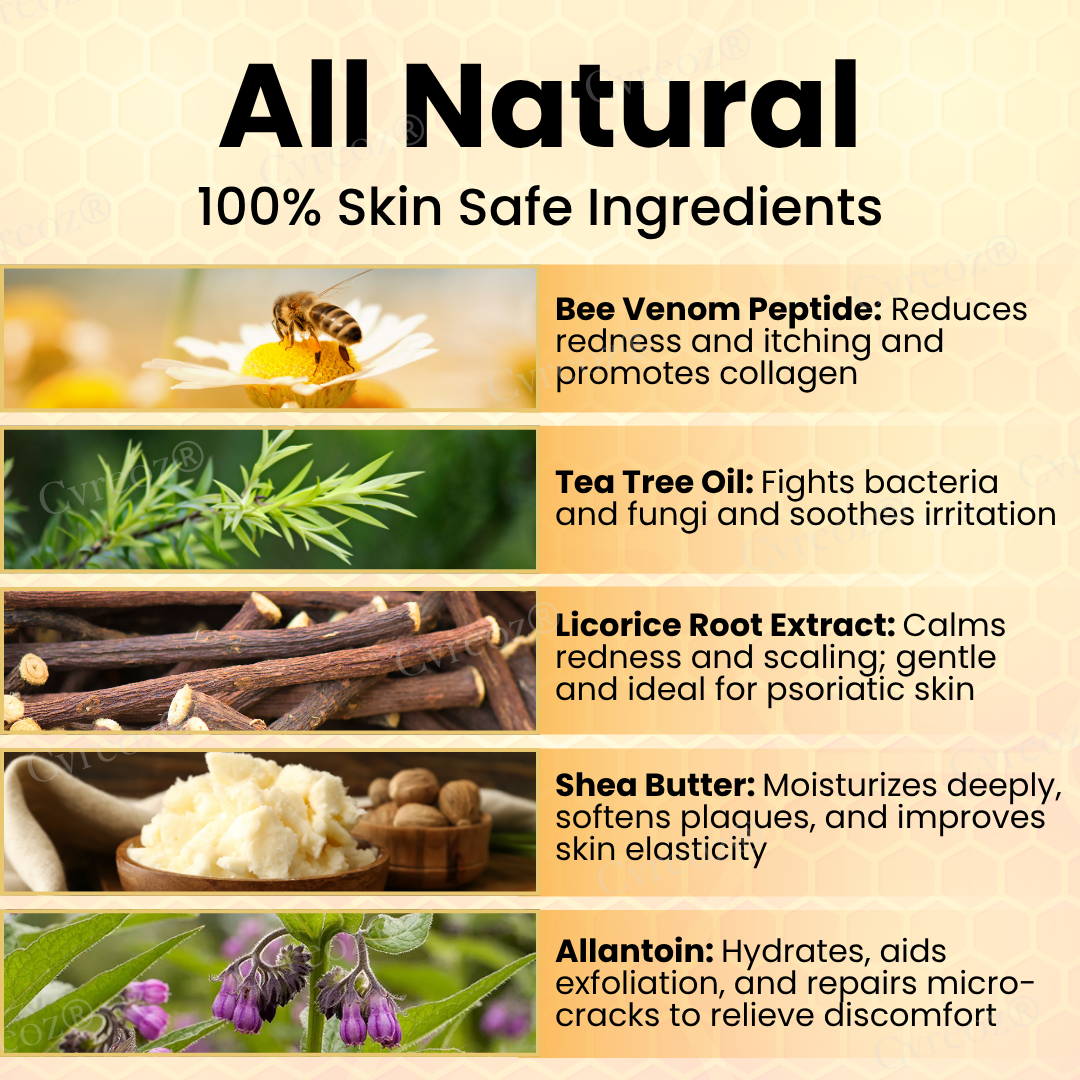 RZXEA™ Bee Venom Psoriasis Care Cream