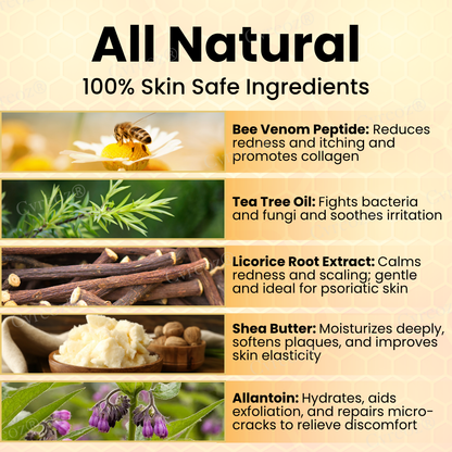 RZXEA™ Bee Venom Psoriasis Care Cream