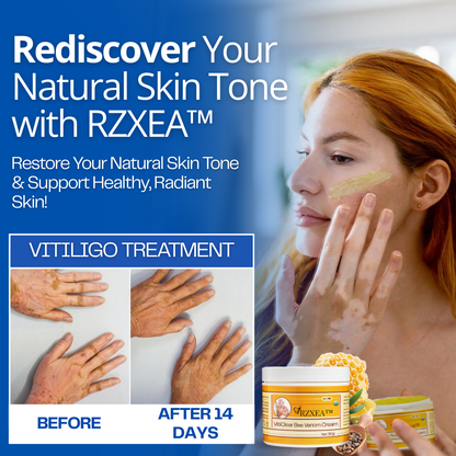 RZXEA™ VitiClear Bee Venom Cream