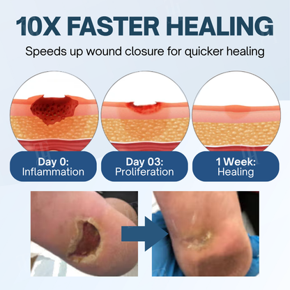 RZXEA™  Ulcer-Relief Diabetes Treatment Cream