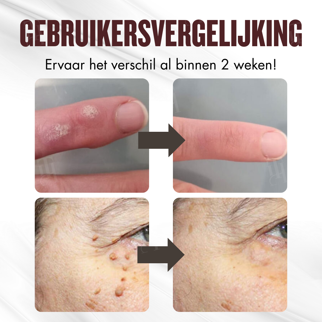 RZXEA™ All-in-1 Ceramide Huidcrème
