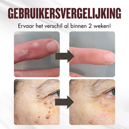 RZXEA™ All-in-1 Ceramide Huidcrème