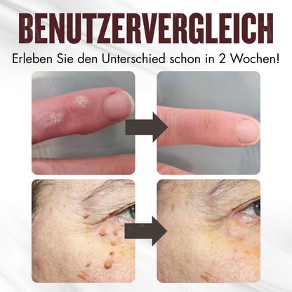 RZXEA™ All-in-1 Ceramide Hautcreme
