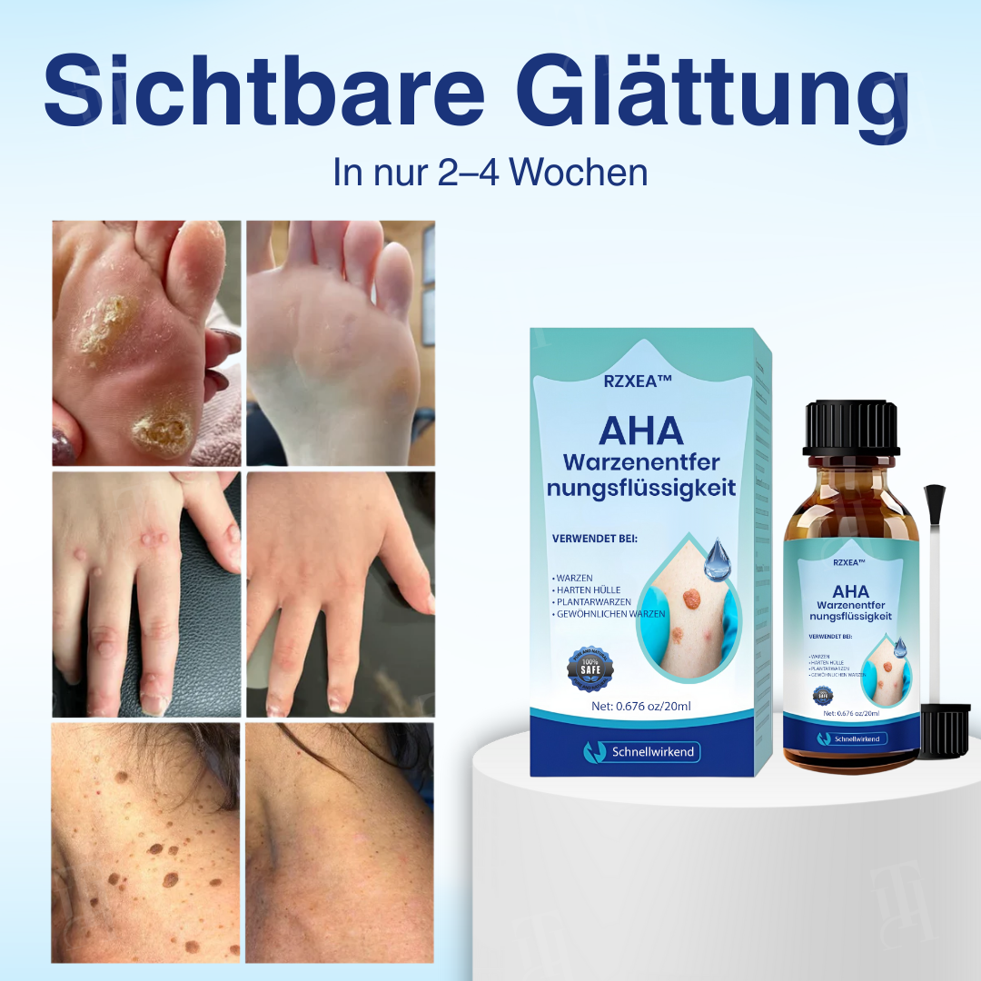 RZXEA™ AHA Warzenentfernungsflüssigkeit