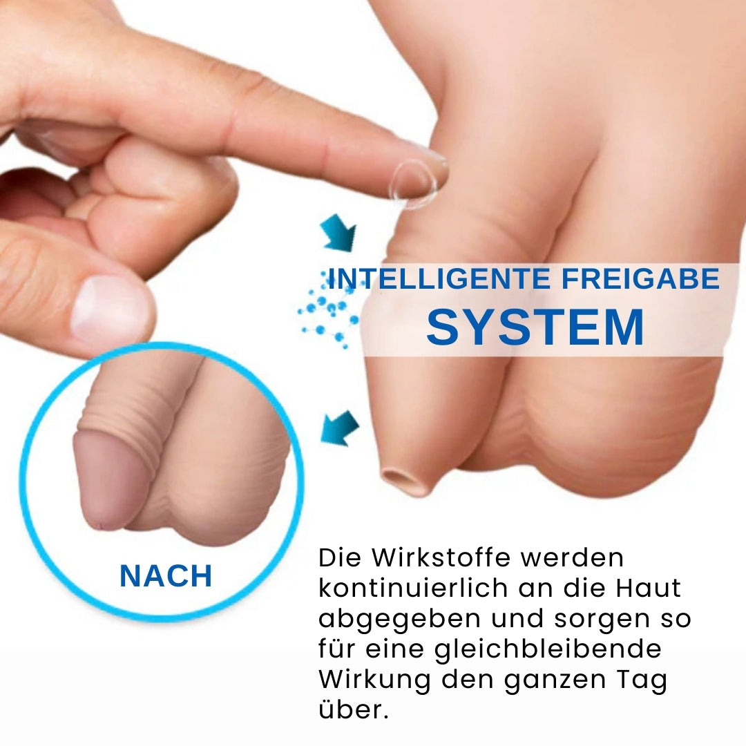 Rzxea™ Redundantes Präputium Korrektur Gel