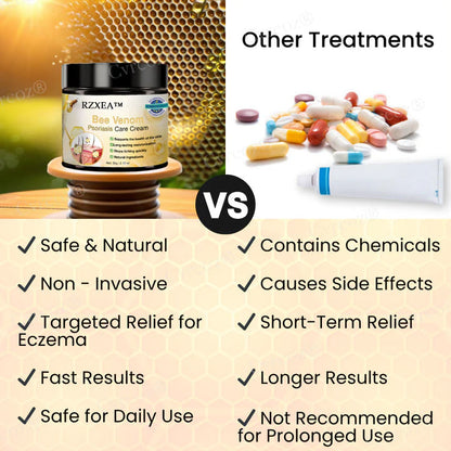 RZXEA™ Bee Venom Psoriasis Care Cream